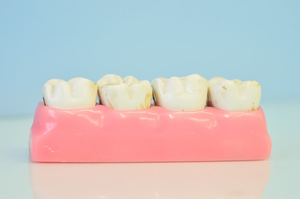teeth macro model, odontological office, teeth-1437437.jpg