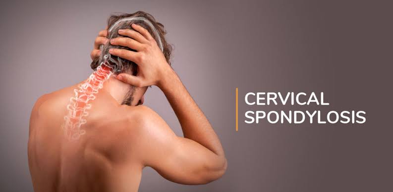 Cervicalspondylosis.jpg