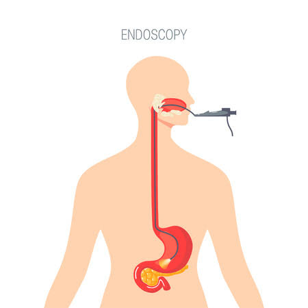 Esophagealvarices.jpg